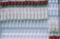 evacuated blood sample tube