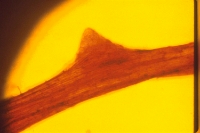 Nodule emerging form cortex