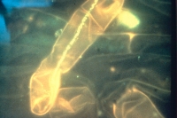 Rhizobia inside infection thread of root hairs