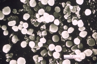 Photomicrographs of rhizobia/bradyrhizobia bacteroids inside nodules