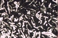 Photomicrographs of rhizobia/bradyrhizobia bacteroids inside nodules