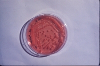 Various R. spp growing on YEM