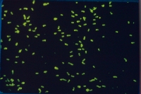 Cells reacted with specific fluorescent antibody
