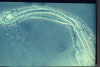 Rhizobia inside infection thread of root hairs