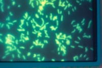 Cells reacted with specific fluorescent antibody