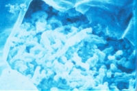 Photomicrographs of rhizobia/bradyrhizobia bacteroids inside nodules