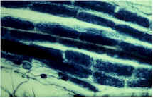 root fungi
